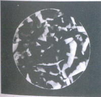 Fig 107 Crack in pavilion facet seen through the crown Fig 107 Crack in pavilion facet seen through the crown