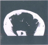 Fig 173 b As Fig 173 a seen through pavilion 