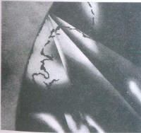 Fracture cracks