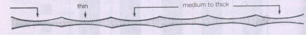 Irregular girdles 